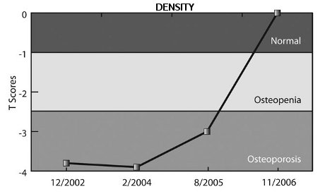 gráfico de densidad ósea