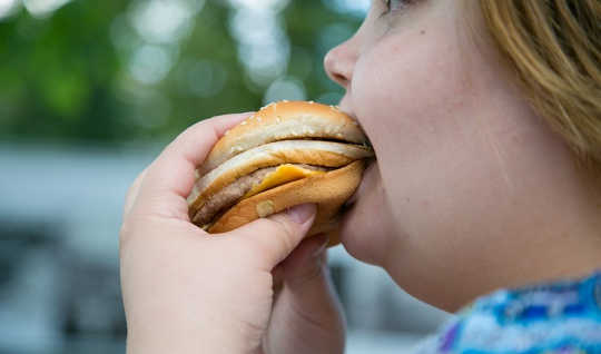 Di Moskow, obesitas terus meningkat karena kebiasaan makan orang-orang Rusia berubah. WHO / Sergey Volkov