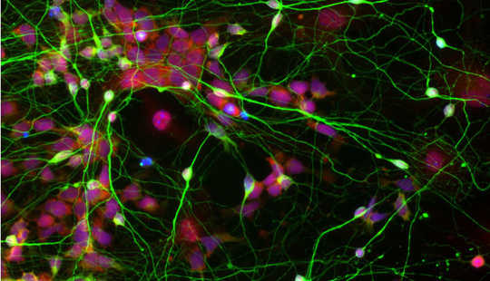 האם תאי גזע אלה נראים לך ליברלים או שמרניים יותר? פן סטייט, CC BY-NC-ND
