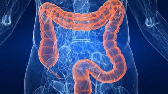 ¿Las bacterias Screwy Gut pueden aumentar su riesgo de diabetes?