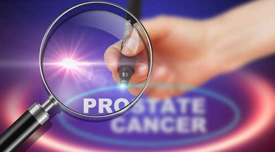 Esta herramienta predice si el cáncer de próstata regresará después de la cirugía