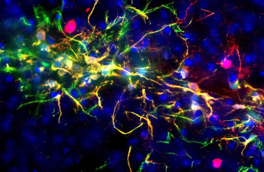 Wissenschaftler entdecken, wie der Hypothalamus des Gehirns das Altern steuert und es verlangsamt
