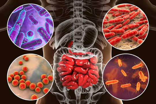 آیا میکروب های روده شما مانع درمان سرطان شما می شوند؟
