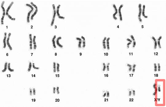 Y-kromosomen försvinner - så vad kommer det för män?