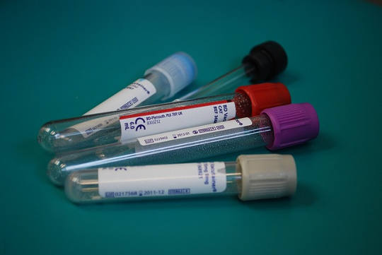 एक नए रक्त परीक्षण उनके प्रारंभिक चरणों में आठ अलग कैंसर का पता लगा सकता है