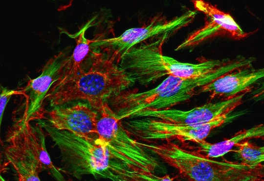 Hur föryngring av stamceller kan leda till hälsosammare åldrande