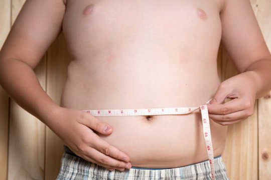 بخش سزارین با افزایش خطر ابتلا به چاقی در کودک همراه است. (بخش سزارین در مقابل تولد طبیعی)