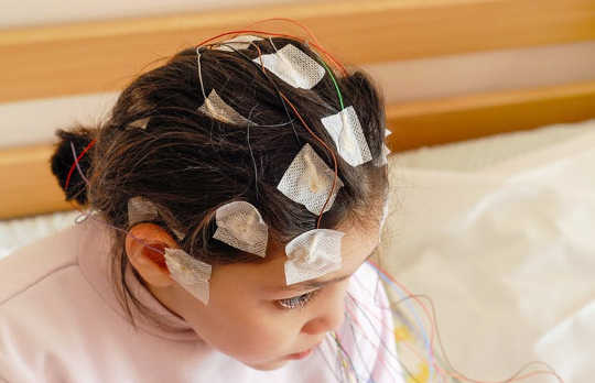 External electrodes can record a brain’s activity. (Could consciousness all come down to the way things vibrate?)