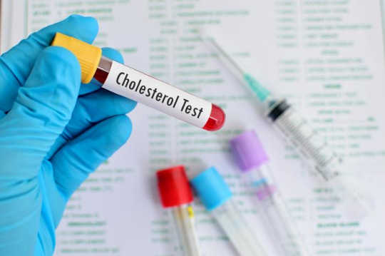 Ujian Kolesterol Mudah Yang Mengatakan Jika Anda Benar-benar Memerlukan Statin