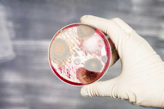 Rauhallisesta rinnakkaiselosta potentiaaliseen vaaraan: bakterit, jotka elävät ja meitä