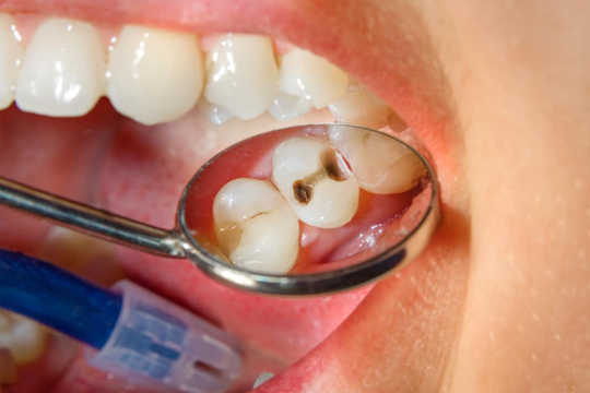Varför borstar du förmodligen dina tänder?