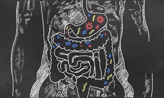 Los microbios intestinales pueden ser quisquillosos: aquí es por qué importa