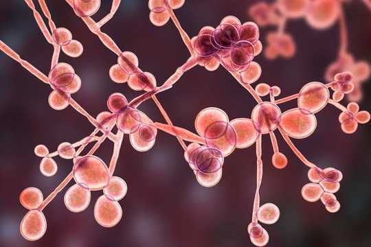 what Is Candida Auris And Who Is At Risk?