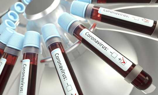 Wie Coronavirus die Blutversorgungskette stört