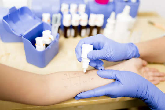 מומחה לאלרגיה יערוך בדיקות, כולל בדיקת דקור בעור, כדי לראות אם ילדך באמת גדל אלרגיה למזון.