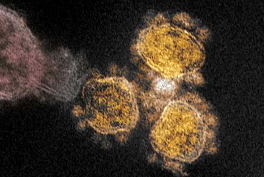 Cách Giữ An Toàn Với Một Biến Thể Coronavirus Mới lây lan nhanh trên cơ thể lỏng lẻo