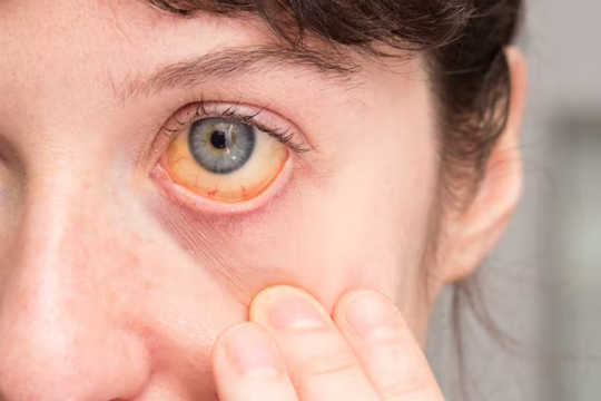 आंखें स्वास्थ्य की भविष्यवाणी करती हैं2 4 9