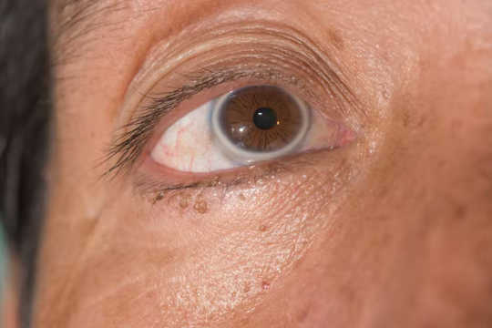 आंखें स्वास्थ्य की भविष्यवाणी करती हैं4 4 9