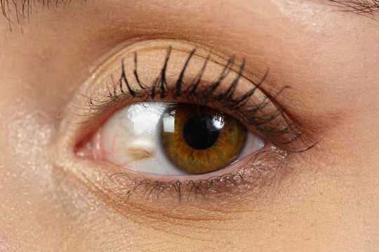 आंखें स्वास्थ्य की भविष्यवाणी करती हैं5 4 9