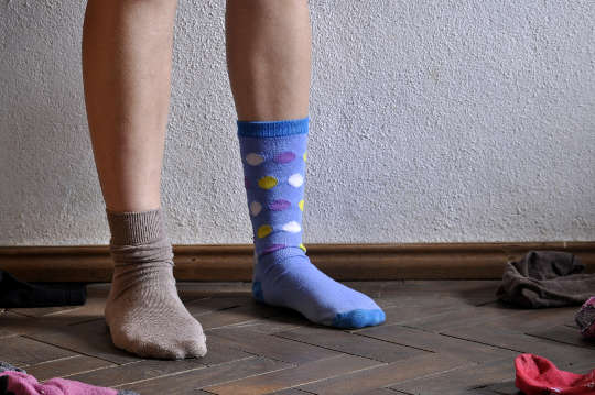 zdjęcie pary nóg w dwóch bardzo różnych kolorowych skarpetach