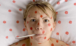 Tout ce que vous devez savoir sur la varicelle