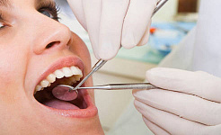 Jak bakterie w jamie ustnej mogą wywołać zapalenie stawów?
