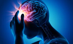 natuurlike behandeling vir migraine 7 11