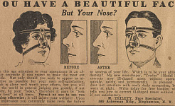 Sejarah Ugutan Pembedahan Kosmetik