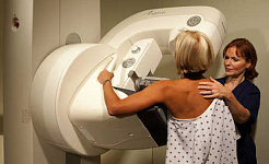 mamografie 3 5