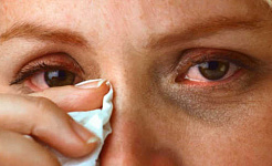 What Is Conjunctivitis And How Did I Get It?