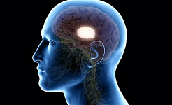sidebillede af et hoved, der viser hjerneskade