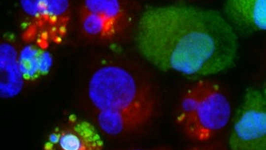 Cómo el canibalismo por las células de cáncer de mama promueve la latencia