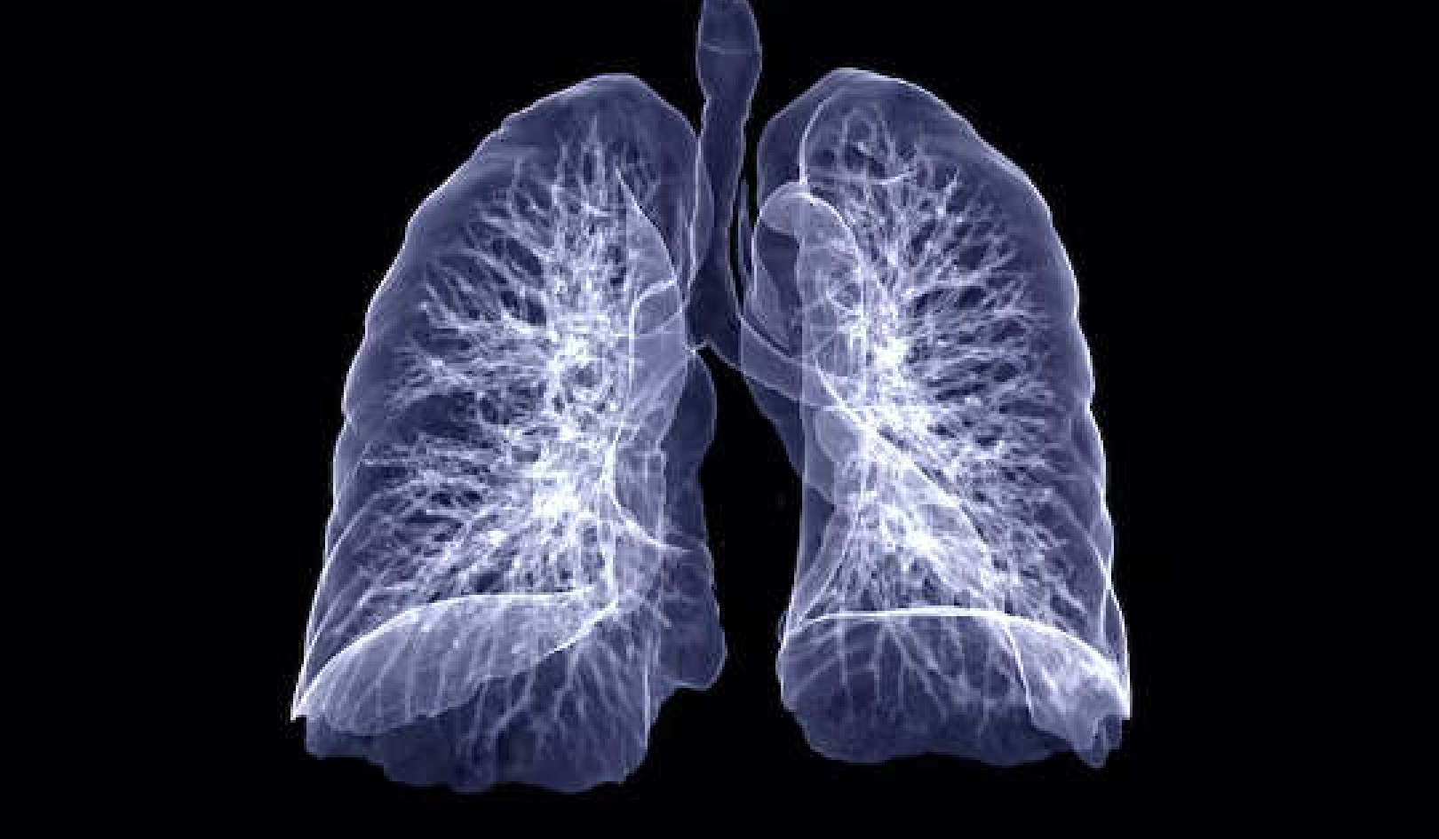 How COVID-19 Can Cause Lasting Lung Damage