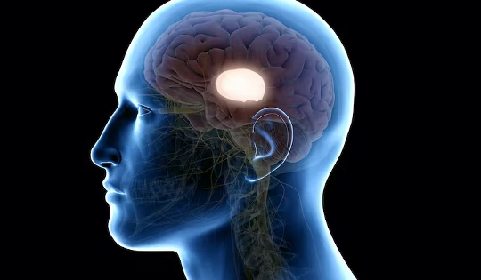 Commozione cerebrale: quasi il 50% ha ancora lesioni cerebrali dopo 6 mesi
