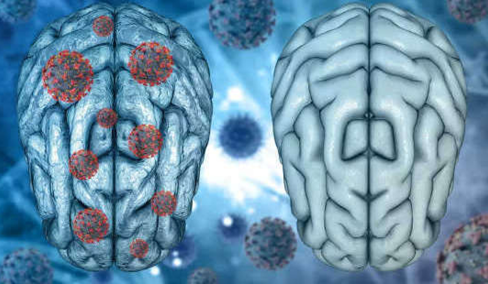 האם מקרים קלים של קוביד-19 משאירים חותם על המוח?