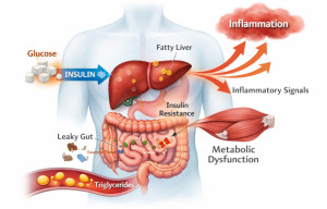 The Metabolic Root of Inflammation