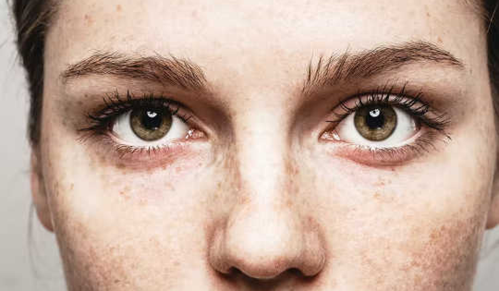 Hva øynene dine avslører om helsen din