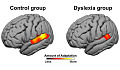 Hersenen van mensen met dyslexie passen zich niet aan nieuwe dingen aan
