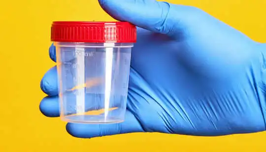 O mână cu mănuși albastre ține o cană de test de urină cu un capac roșu