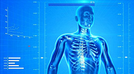 ¿Podemos prevenir la osteoporosis?