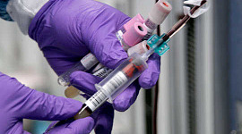 Este teste de sangue simples poderia detectar doença hepática oculta