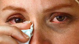 What Is Conjunctivitis And How Did I Get It?