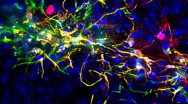 اكتشف العلماء كيف يتحكم Hypothalamus الدماغ في الشيخوخة وإدارة لإبطائه