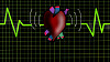 Tại sao suy tim không phổ biến như một cái chết như các báo cáo ngụ ý
