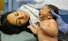 How Birth Interventions Affect Babies' Health In The Short And Long Term