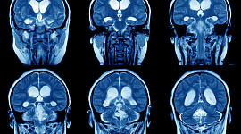 Was ist Gehirnplastizität und warum ist sie so wichtig?