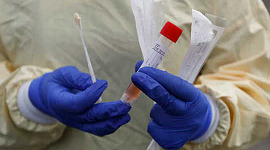 Чому зробити тестування на коронавірус простим, точним і швидким є вирішальним для припинення пандемії