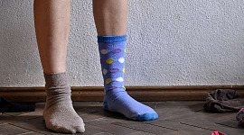 photo of a pair of legs wearing two very different color socks