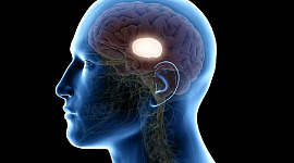脳の損傷を示す頭部の側面図